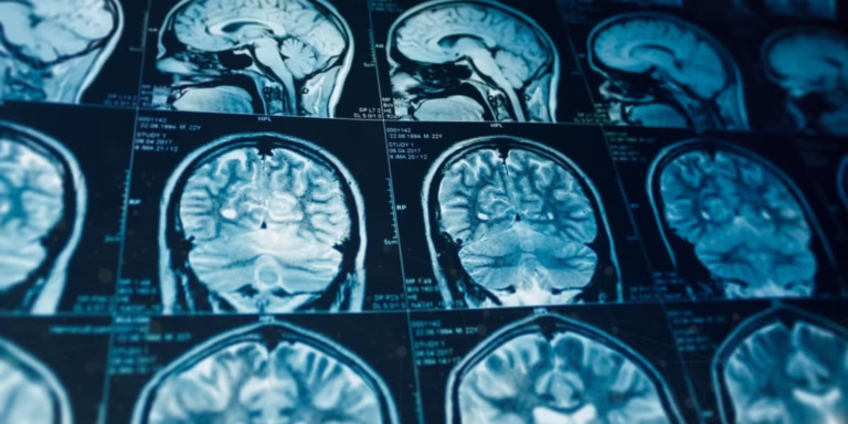 brain-mri-1-1140x570